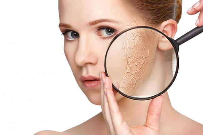 Nguyên nhân và cách khắc phục da bị khô